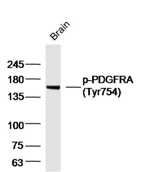 Phospho-PDGFRA (Tyr754) Rabbit Polyclonal Antibody