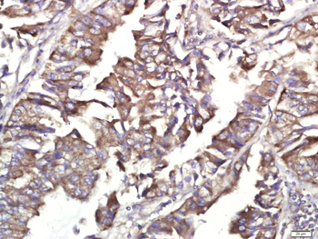 Phospho-IRAK1 (Thr209) Rabbit Polyclonal Antibody