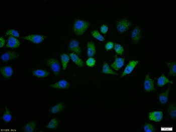 IRAK1 (phospho-Thr209) antibody