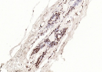 STAT3 (phospho-Tyr705) antibody