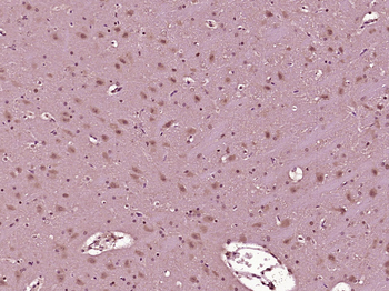 Phospho-AMPK beta 1 + AMPK beta 2 (Ser182/Ser184) Rabbit Polyclonal Antibody