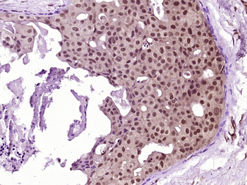 Phospho-AKT (Ser473) Mouse Monoclonal Antibody