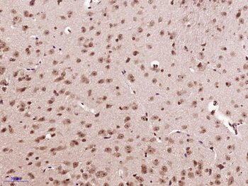 Phospho-Gli1 (S112/ T115/ S116) Rabbit Polyclonal Antibody