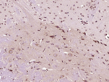 Phospho-Gli1 (T101/ S102/S104) Rabbit Polyclonal Antibody