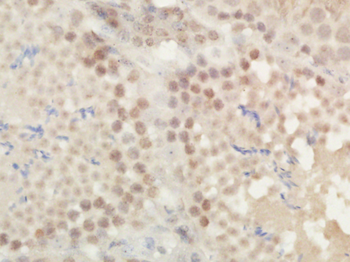Phospho-ROCK2 (Tyr256) Rabbit Polyclonal Antibody
