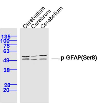 Phospho-GFAP (Ser8) Rabbit Polyclonal Antibody