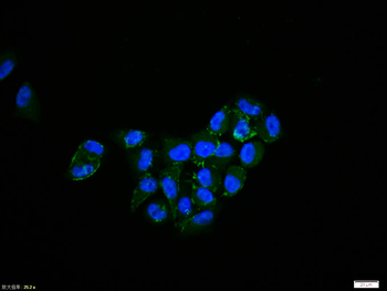 Phospho-EGFR (Tyr1110) Rabbit Polyclonal Antibody