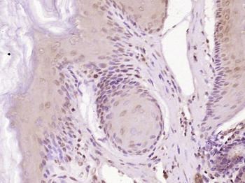 Phospho-EGFR (Tyr1110) Rabbit Polyclonal Antibody