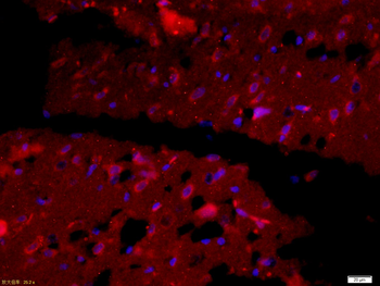 ENO1 Rabbit Polyclonal Antibody
