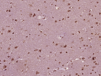 Phospho-MEK1 + MEK2 (Ser222) Rabbit Polyclonal Antibody