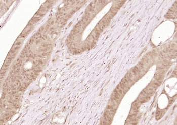 Phospho-ERK5 (Ser496) Rabbit Polyclonal Antibody