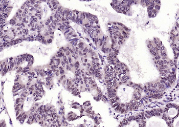 Phospho-FADD (Ser194) Rabbit Polyclonal Antibody