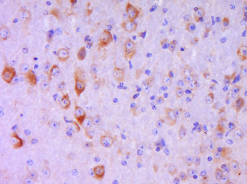 Phospho-FAK (Tyr407) Rabbit Polyclonal Antibody