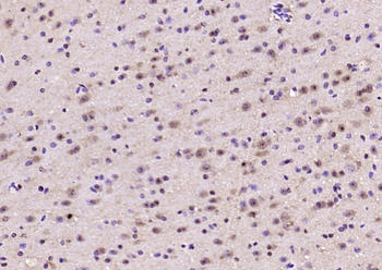 Phospho-FAK (Ser722) Rabbit Polyclonal Antibody