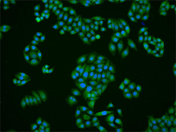 FBP1 Rabbit Polyclonal Antibody