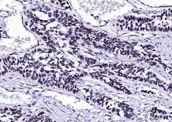 Phospho-FGFR1 (Tyr307) Rabbit Polyclonal Antibody