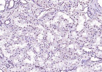 FGFR1 (phospho-Tyr307) antibody