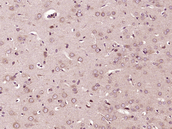 ABCG1 Rabbit Polyclonal Antibody