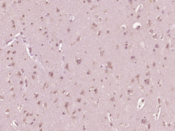 IFNB1 Rabbit Polyclonal Antibody