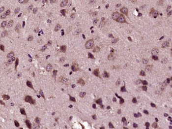 IL-6R alpha Rabbit Polyclonal Antibody