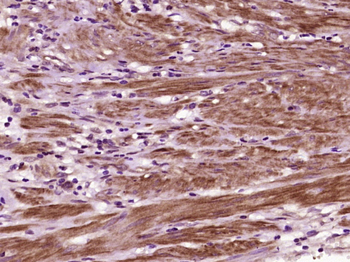 SLFN13 Rabbit Polyclonal Antibody