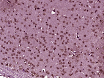 ZMIZ2 Rabbit Polyclonal Antibody
