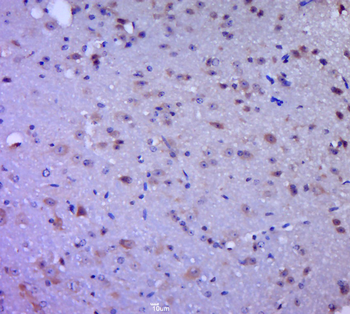 CNOT6 Rabbit Polyclonal Antibody