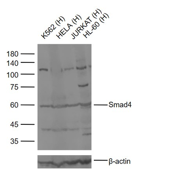 Smad4 Rabbit Polyclonal Antibody