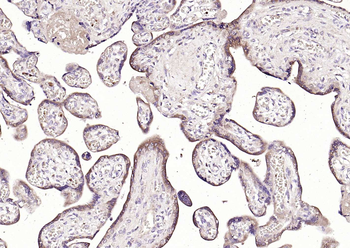 HSD3B1+ HSD3B2 Rabbit Polyclonal Antibody