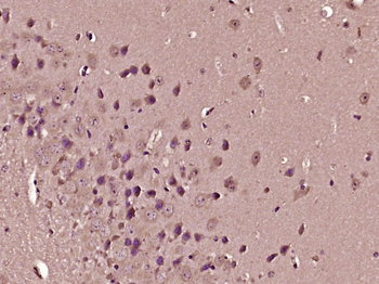 Apelin Receptor Rabbit Polyclonal Antibody