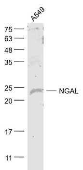 NGAL antibody