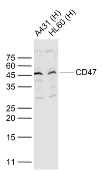 CD47 Rabbit Polyclonal Antibody