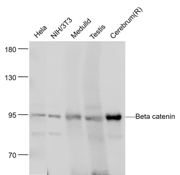 Beta catenin Mouse Monoclonal Antibody