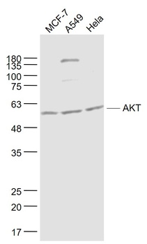 AKT antibody