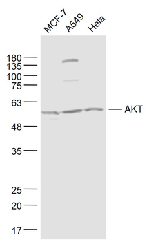 AKT Mouse Monoclonal Antibody
