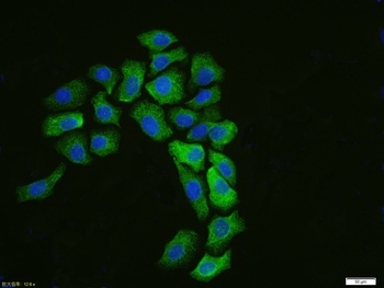 Cytokeratin 19 antibody