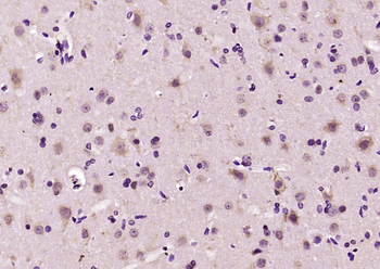 NR3C2/Mineralocorticoid receptor Rabbit Polyclonal Antibody