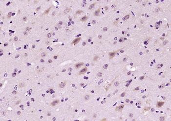 NR3C2/Mineralocorticoid receptor Rabbit Polyclonal Antibody