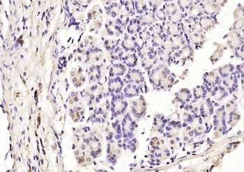 Myocardin Rabbit Polyclonal Antibody