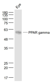 PPAR gamma Mouse Monoclonal Antibody