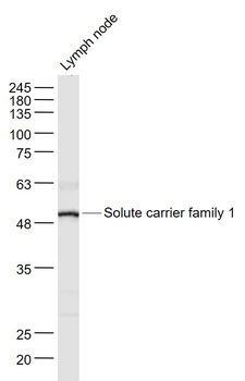 SLC1A5 Rabbit Polyclonal Antibody