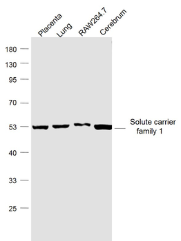 SLC1A5 Rabbit Polyclonal Antibody