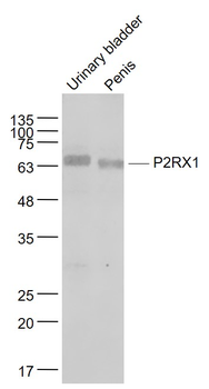 P2RX1 Rabbit Polyclonal Antibody
