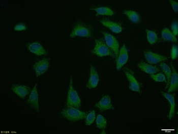 Vinculin antibody