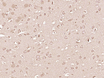 Beta-arrestin 2 Rabbit Polyclonal Antibody