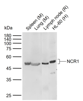 NCR1 Rabbit Polyclonal Antibody