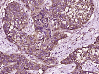 TFF2 Rabbit Polyclonal Antibody
