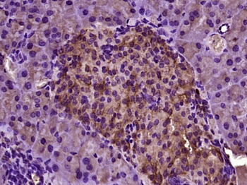 PLRP2 Rabbit Polyclonal Antibody