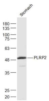 PLRP2 Rabbit Polyclonal Antibody