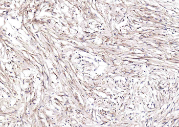 Collagen II Mouse Monoclonal Antibody